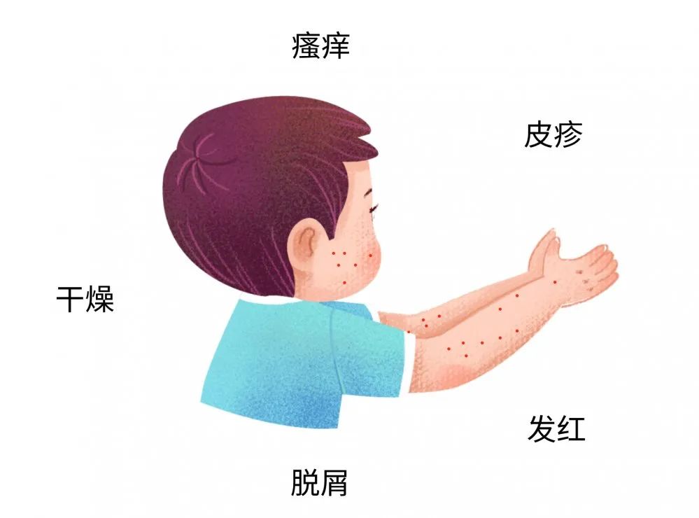 这些症状都可能是宝宝过敏传递的信号，，很多宝妈还不知道
